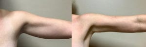 Before and After Image