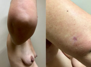 Before and After Image