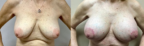 Before and After Image