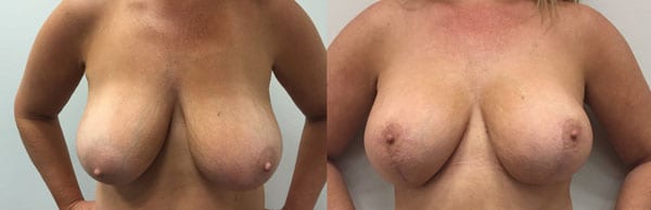 Before and After Image