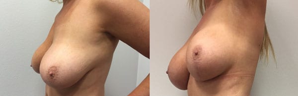 Before and After Image