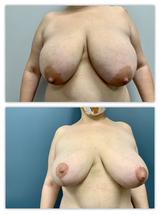 Before and After Image