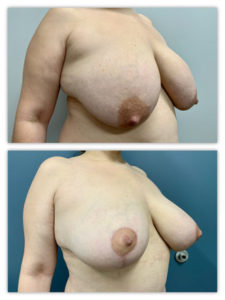 Before and After Image