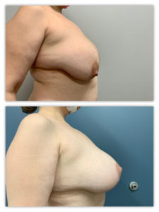 Before and After Image