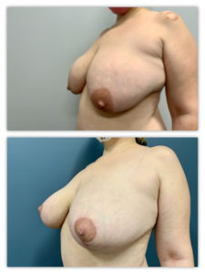 Before and After Image