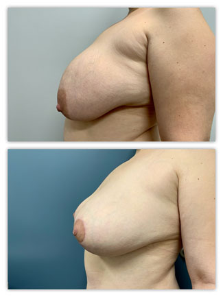 Before and After Image