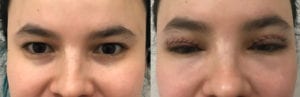 Before and After Image