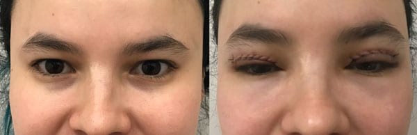 Before and After Image