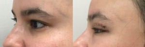 Before and After Image