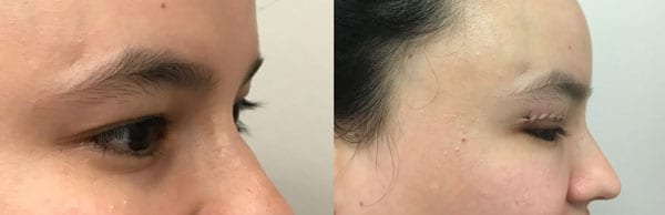 Before and After Image