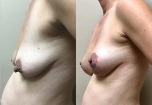 Before and After Image