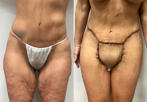 Before and After Image