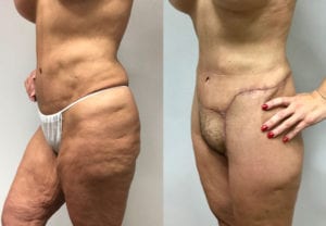 Before and After Image