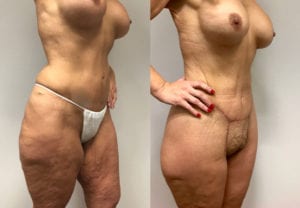 Before and After Image