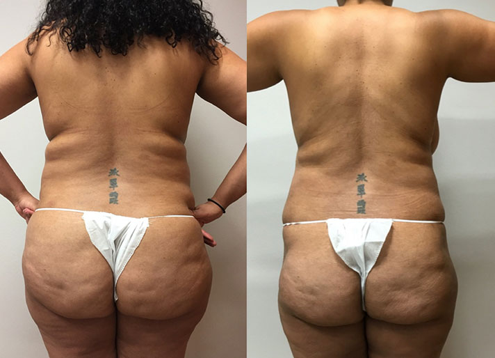 Before and After Image