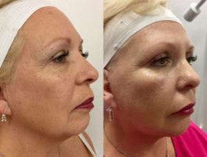 Before and After Image
