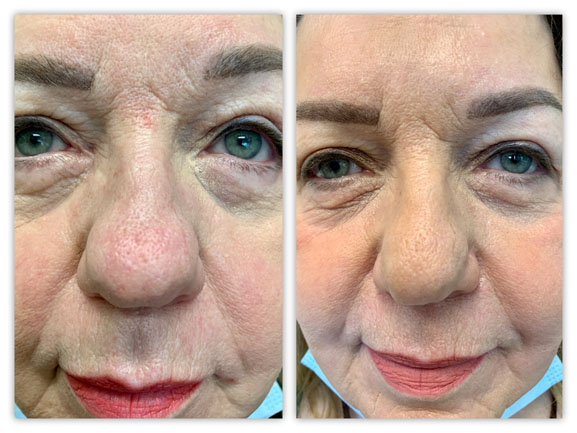 Before and After Image