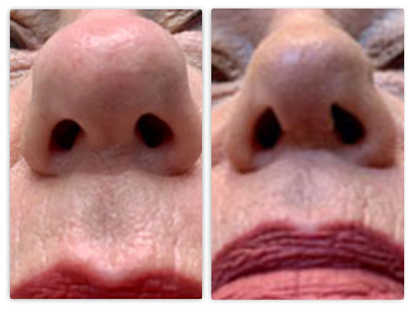 Before and After Image