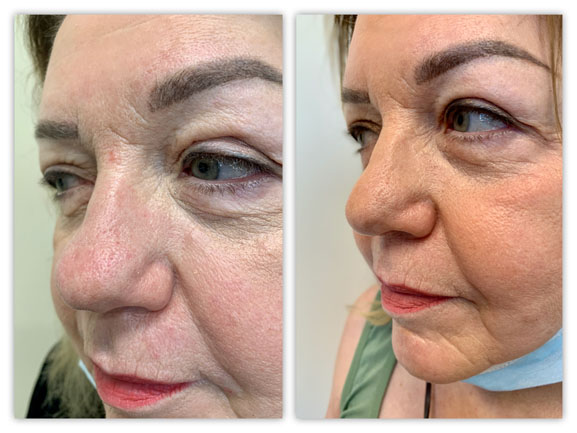 Before and After Image