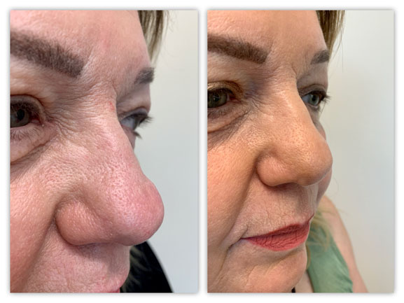 Before and After Image